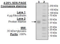 Mesothelin, Avi-His-Tag, HiP™ Recombinant – Figure 1 of 2