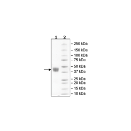 Mesothelin, Avi-His-Tag, Biotin-Labeled, HiP™ Recombinant – Figure 1 of 2