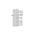 MICA, Fc fusion, Avi-Tag, Biotin-labeled Recombinant – Figure 1 of 1