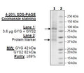 GYG/GYS2 Complex Recombinant – Figure 1 of 1