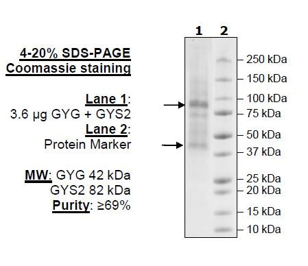 GYG/GYS2 Complex Recombinant – Figure 1 of 1