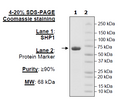 SHP1, His-Tag (2-595) Recombinant – Figure 1 of 2
