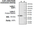 SHP-1 (Catalytic Domain), His-Tag (221-523) Recombinant – Figure 1 of 2