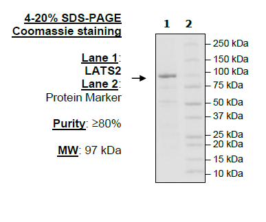 LATS2, GST-Tag Recombinant – Figure 1 of 1