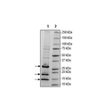 ELOB/ELOC/VHL Complex Recombinant – Figure 1 of 3