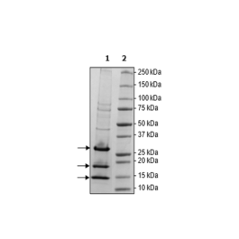 ELOB/ELOC/VHL Complex Recombinant – Figure 1 of 3