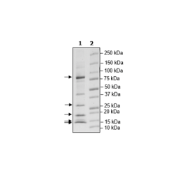 VHL/CUL2/ELOB/ELOC/RBX1 Complex Recombinant – Figure 1 of 3