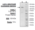 TET2, FLAG-Tag, His-Tag (916-2002) Recombinant – Figure 1 of 1