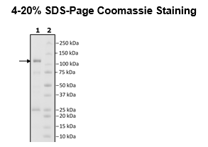MDM2, GST-tag Recombinant – Figure 1 of 2