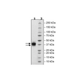 IL2RB, Avi-His-Tag, Biotin-Labeled Recombinant – Figure 1 of 2