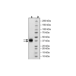 IL2RB, Avi-His-Tag, Biotin-Labeled Recombinant – Figure 1 of 2