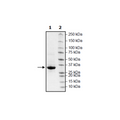 Protein A, Cys-His-Tag (S. aureus) Recombinant – Figure 1 of 1