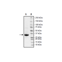 Protein A, Cys-His-Tag (S. aureus) Recombinant – Figure 1 of 1