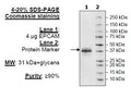 EpCAM, Avi-His-Tag Recombinant – Figure 1 of 1