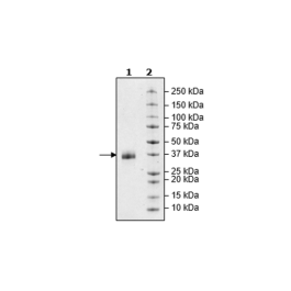 EpCAM, Avi-His-Tag, Biotin Labeled Recombinant – Figure 1 of 1