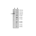 PSMA, His-Avi-Tag, Biotin-Labeled Recombinant – Figure 1 of 2