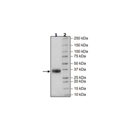 BTN1A1 Avi-His-Tag Recombinant – Figure 1 of 1