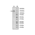 ADAR1, FLAG-Tag Recombinant – Figure 1 of 3