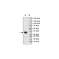 FCGR2B, Avi-His-Tag, Biotin-Labeled Recombinant – Figure 1 of 1