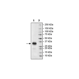 FCGR2B, Avi-His-Tag, Biotin-Labeled Recombinant – Figure 1 of 1