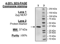 NEK7, His-Tag Recombinant – Figure 1 of 2