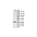 COMT, His-Tag Recombinant – Figure 1 of 1