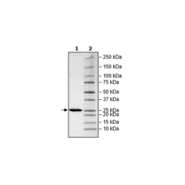 COMT, His-Tag Recombinant – Figure 1 of 1