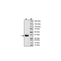 p120GAP, His-Tag Recombinant – Figure 1 of 2