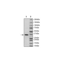 c-RAF, GST-Tag Recombinant – Figure 1 of 2