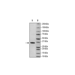 c-RAF, GST-Tag Recombinant – Figure 1 of 2