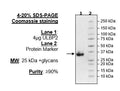 ULBP2, Avi-His-Tag Recombinant – Figure 1 of 1