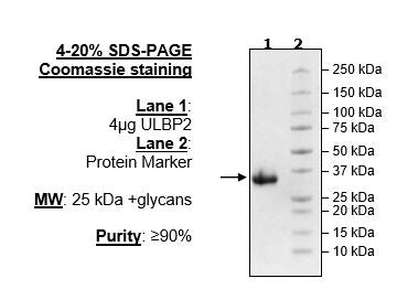 ULBP2, Avi-His-Tag Recombinant – Figure 1 of 1