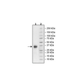 ULBP2, Avi-His-Tag, Biotin-labeled Recombinant – Figure 1 of 1