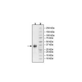 ULBP2, Avi-His-Tag, Biotin-labeled Recombinant – Figure 1 of 1