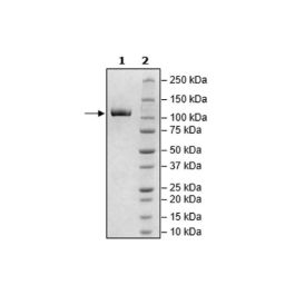 ERAP1, Avi-His-Tag, Biotin-labeled Recombinant – Figure 1 of 2