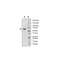 TGFβR2, Fc Fusion, Avi-tag, Biotin-labeled HiP™ Recombinant – Figure 1 of 2