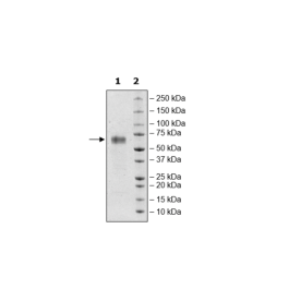 TGFβR2, Fc Fusion, Avi-tag, Biotin-labeled HiP™ Recombinant – Figure 1 of 2