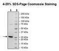 KRAS (G12C), Isoform A, His-Tag, GDP-Loaded Recombinant – Figure 1 of 3
