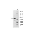 TGFβR1, Fc Fusion (IgG1) Avi-Tag, Biotin Labeled Recombinant – Figure 1 of 1