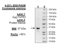FGFR3 (V555F), His-Tag (Dephosphorylated) Recombinant – Figure 1 of 1