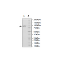 StcE, His-Tag Recombinant – Figure 1 of 1