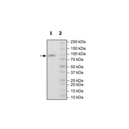 StcE, His-Tag Recombinant – Figure 1 of 1