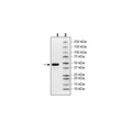 Nectin4, His-Avi-Tag HiP™ Recombinant – Figure 1 of 2