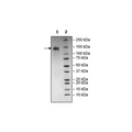 Spike S1 (13-665), Fc Fusion, Avi-tag (SARS-CoV-2) Recombinant – Figure 1 of 2
