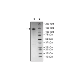 Spike S1 (13-665), Fc Fusion, Avi-tag (SARS-CoV-2) Recombinant – Figure 1 of 2