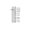 Spike S1 (13-665), Fc fusion, Avi-tag, Biotin-Labeled (SARS-CoV-2) Recombinant – Figure 1 of 3