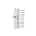 Spike S1 RBD, Mouse Fc-fusion (SARS-CoV-2) Recombinant – Figure 1 of 2