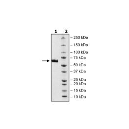 Spike S1 RBD, Mouse Fc-fusion (SARS-CoV-2) Recombinant – Figure 1 of 2
