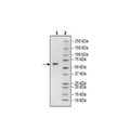 Anti-BCMA-Anti-CD3 Bispecific Molecule – Figure 1 of 4