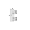FGFR1, Avi-His-Tag, Biotin-labeled (Dephosphorylated) Recombinant – Figure 1 of 2
